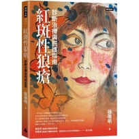 紅斑性狼瘡:診斷治療與照護指南