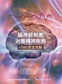 腦神經刺激治療精神疾病 rTMS 完全攻略